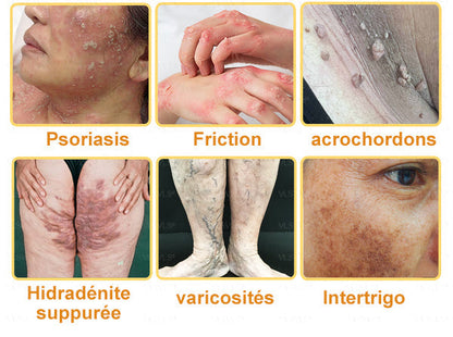 Venin d'abeille Creme de tratamento da artrite em venin d'abeille