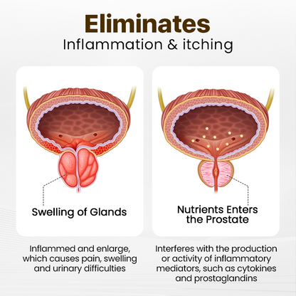 Say goodbye to prostate discomfort 🍀 ProstaPower Bee Inhalation Stick 🍀 (Fast-acting and long-lasting)