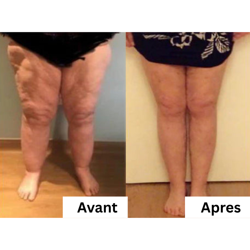 PEARLMOON® – Gaine Amincissante Sculptante