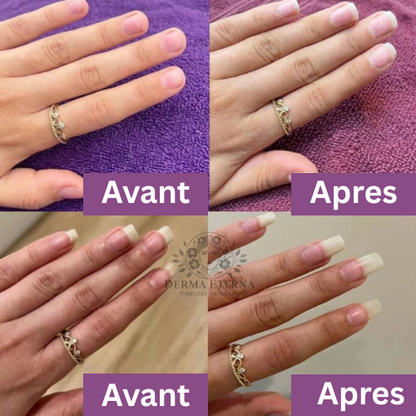 Sérum de Croissance des Ongles 