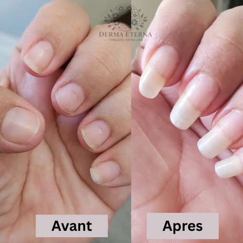 Sérum de Croissance des Ongles 