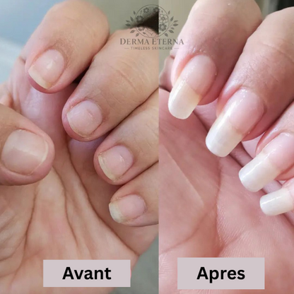 Sérum de Croissance des Ongles 