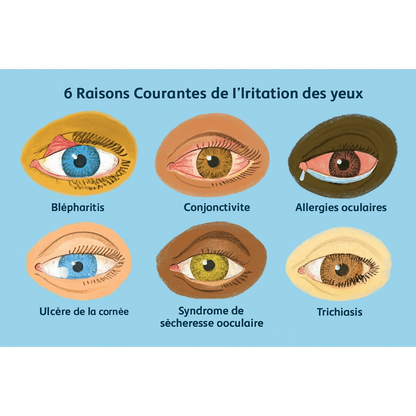 EELHOE – Thérapie réparatrice pour les yeux