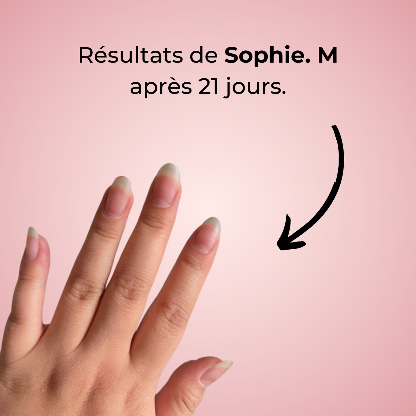Sérum de Croissance des Ongles 