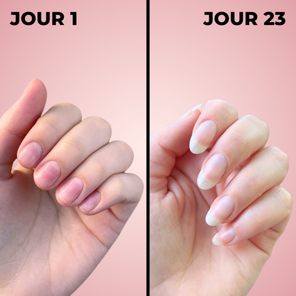 Sérum de Croissance des Ongles 