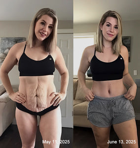 Bee Venom Shaping cream : Sculptez votre corps de rêve avec notre crème – Résultats visibles rapidement !