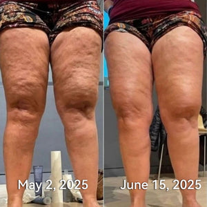 Bee Venom Shaping cream : Sculptez votre corps de rêve avec notre crème – Résultats visibles rapidement !